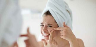 How to Get Rid of Acne How to Get Rid of Acne