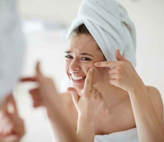 How to Get Rid of Acne How to Get Rid of Acne