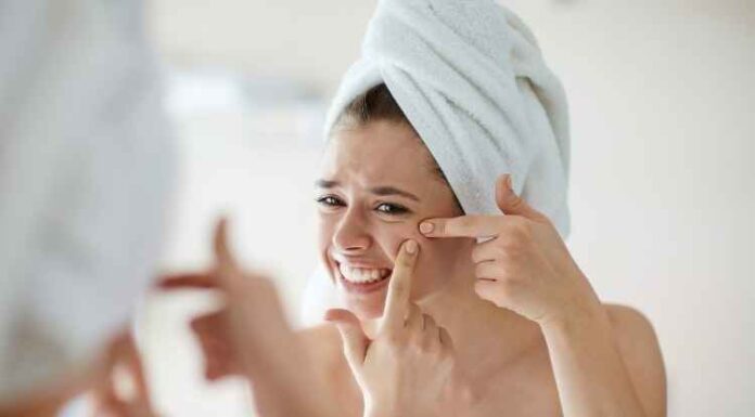 How to Get Rid of Acne How to Get Rid of Acne