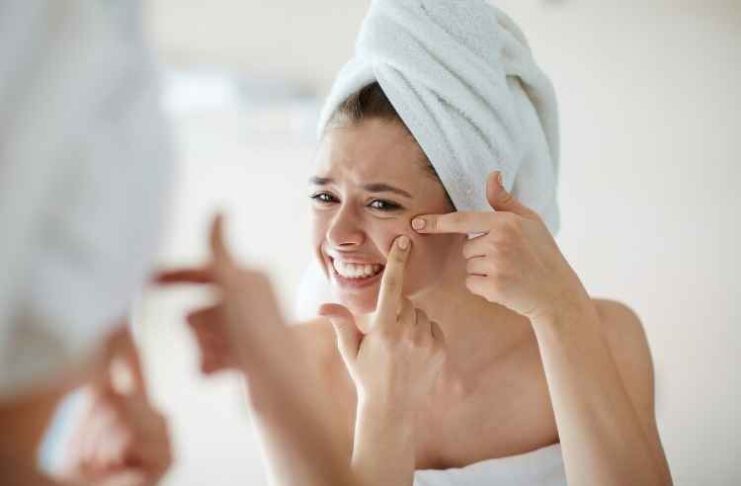 How to Get Rid of Acne